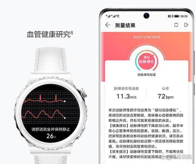 为WATCH GT3 Pro性价比之选凯发赛事合作热门智能手表品牌推荐：华(图5)
